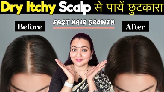 Read more about the article Best Way to Fix Dry and Itchy Scalp at Home | Preity Prerna