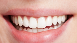 Read more about the article Teeth Whitening and Oral Hygiene | Preity Prerna