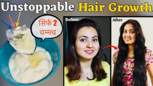 Read more about the article This DIY Hair Tonic to Regrow Lost Hair | Preity Prerna