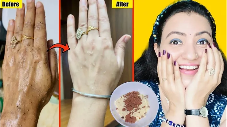 You are currently viewing Hands And Feet Brightening At Home Naturally | Preity Prerna