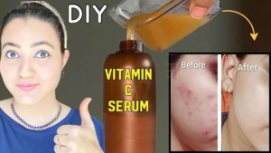 Read more about the article How To Make Vitamin C Serum At Home?